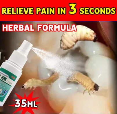 Toothache oral spray toothache reliever toothache pain relief teeth care sprays 35ml Prevent Oral